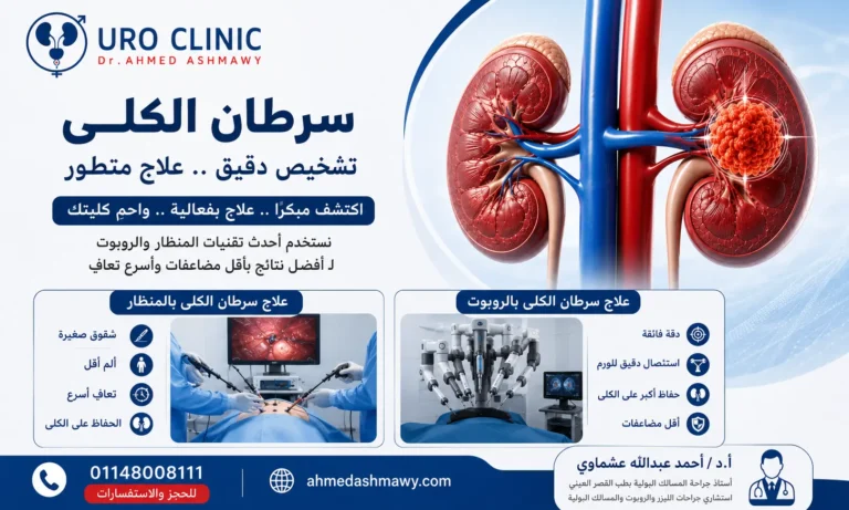 أعراض سرطان الكلى في مراحله الأولى