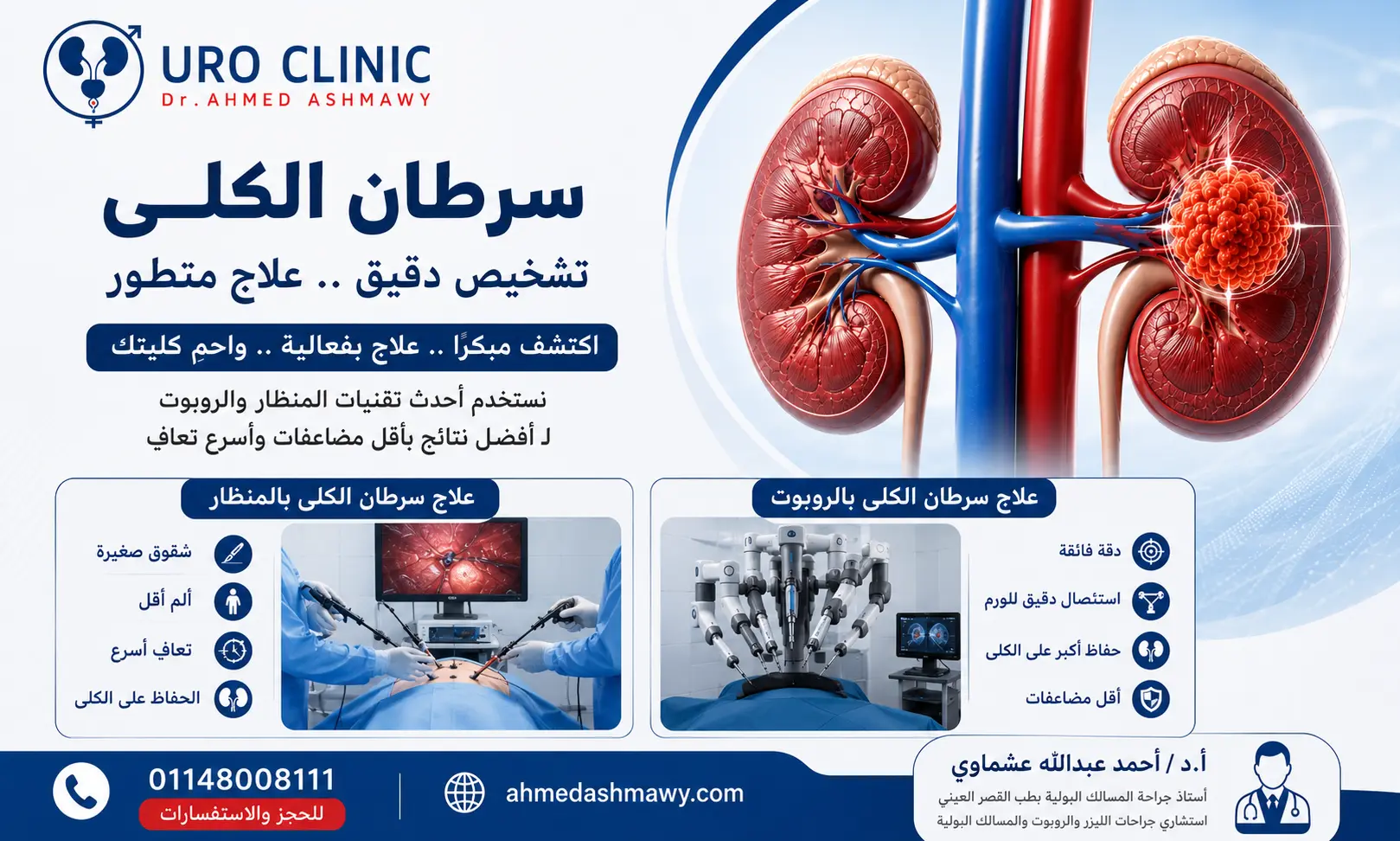 أعراض سرطان الكلى في مراحله الأولى