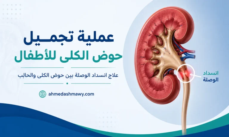 عملية تجميل حوض الكلى للأطفال