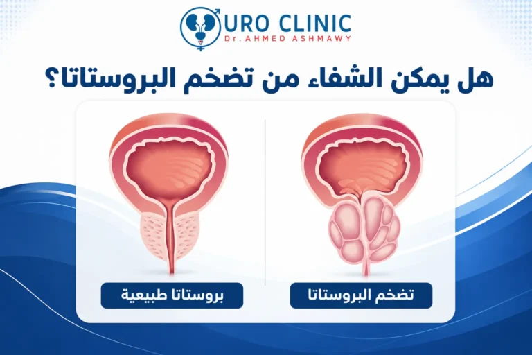 هل يمكن الشفاء من تضخم البروستاتا